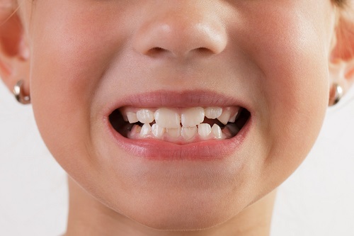 Baby face with an open mouth and teeth